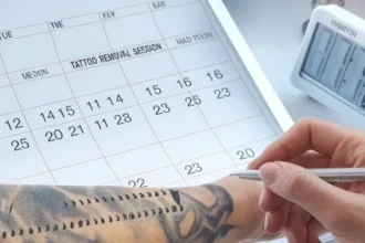 A realistic image showing a calendar and fading tattoo progression, illustrating how long the tattoo removal process takes over several sessions.