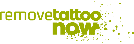 Remove Tattoo Now